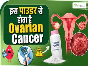 Ovarian Cancer का कारण है ये Talcum Powder? जानें क्या कहते हैं Oncologist Dr. Anil Thakwani
