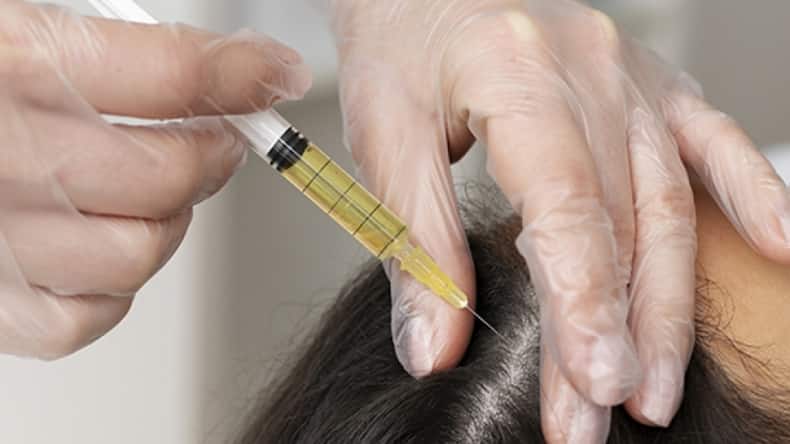 5 alternatives to spironolactone to reverse hair loss