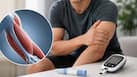 Poor muscle health may raise type 2 diabetes risk by reducing blood sugar control, study finds