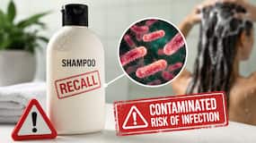Shampoo recall alert: Contaminated product could trigger infections in vulnerable people Shampoo recall alert: Contaminated product could trigger infections in vulnerable people