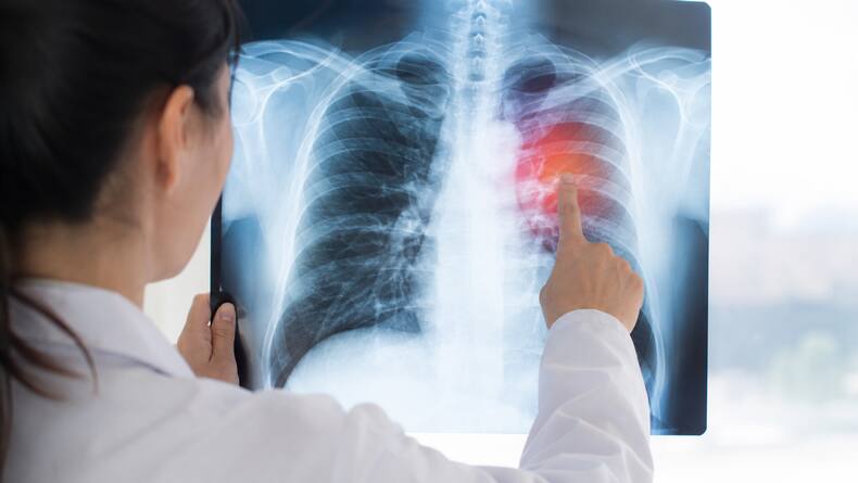 thehealthsite.com top news