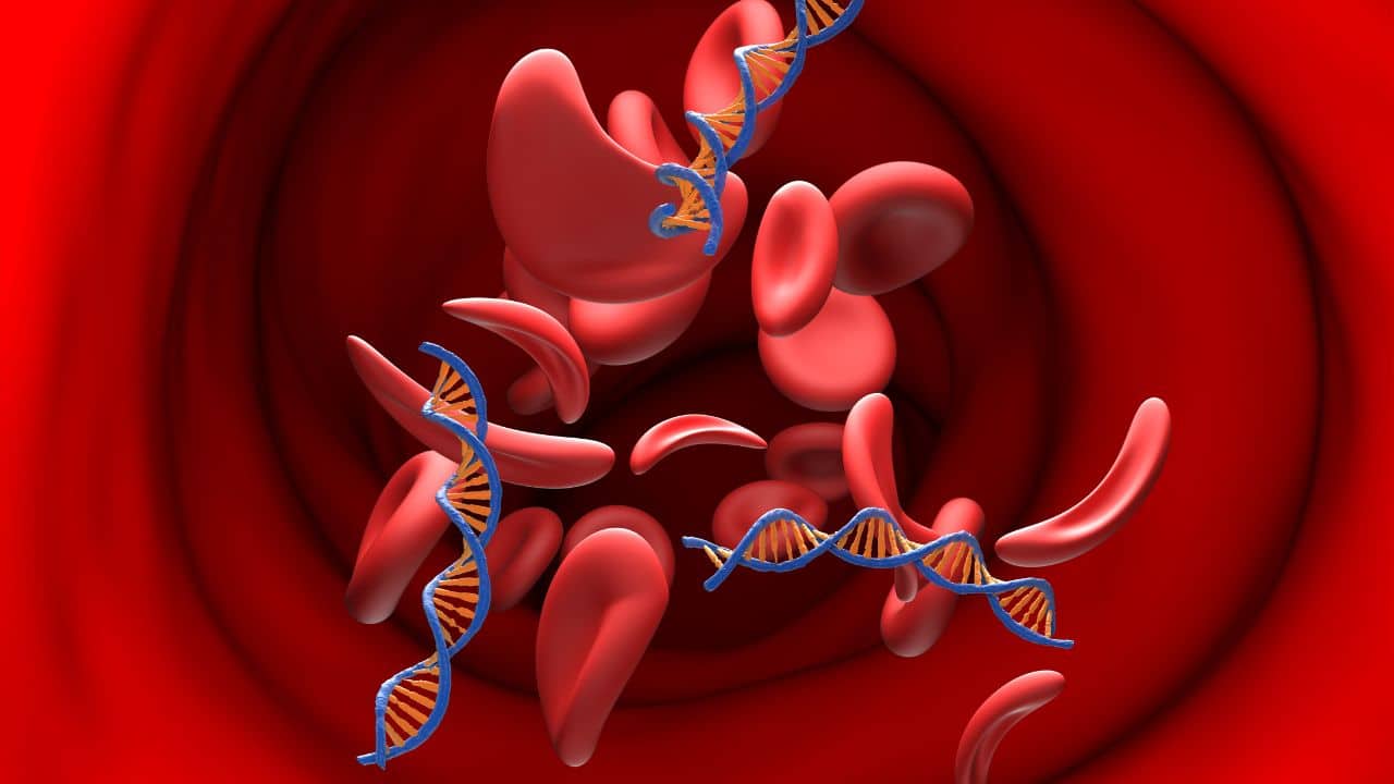 Teenage anemia