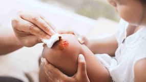 Why burn injuries are more common in children: Doctor shares prevention tips every parent should know
