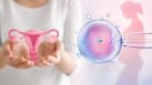 World IVF Day 2026: Can women with PCOS get pregnant? Gynaecologist explains fertility, treatment and IVF options