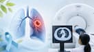 World Lung Cancer Day: Who should get lung cancer screening? Warning signs, risk factors and when to get tested