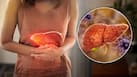 Your liver may be silently failing: Doctor reveals 5 warning signs you should never ignore