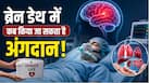 Brain Death क्या होती है? कब किया जा सकता है अंगदान, जानिए डॉक्टर क्या कहते हैं