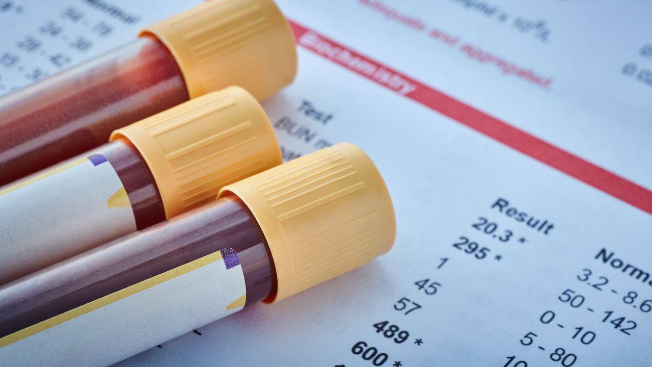 fatty liver test