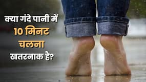 क्या गंदे पानी में 10 मिनट चलना भी स्किन इंफेक्शन का कारण बन सकता है?