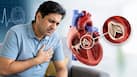 कैसे पता चलेगा कि हार्ट वाल्व खराब हो रही है? किन लक्षणों को इग्नोर करना  हो सकता है जानलेवा