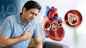 कैसे पता चलेगा कि हार्ट वाल्व खराब हो रही है? किन लक्षणों को इग्नोर करना  हो सकता है जानलेवा