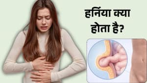 हर्निया क्या है? जानें यह बीमारी क्यों और कब बन सकती है खतरनाक