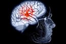 Brain fog or brain tumour? Warning signs your cognitive health is in danger