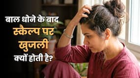 हेड वाश करने के बाद भी स्कैल्प पर खुजली होने का क्या कारण है? एक्सपर्ट से जानें