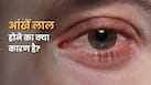 आंखों का सफेद हिस्सा लाल क्यों हो जाता है? जानें इसके कारण और कब डॉक्टर से मिलना चाहिए
