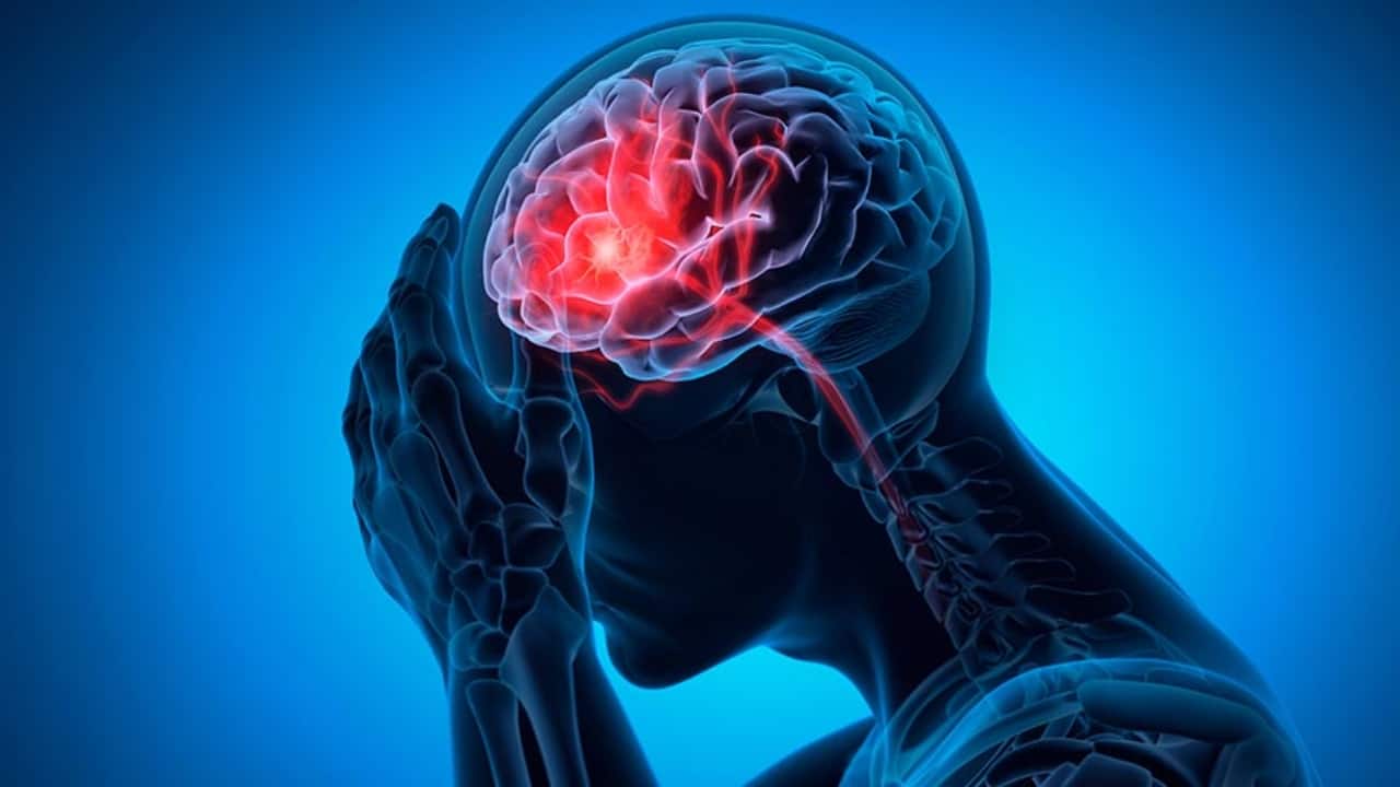 silent stroke