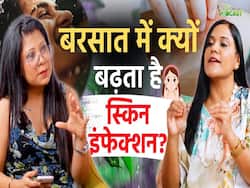 Skin Infection Home Remedies:इस मौसम में होती है सबसे ज्यादा स्किन प्रॉब्लम!