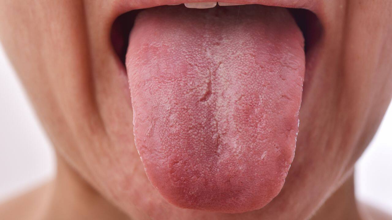 tongue color affect Stomach Health