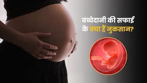बच्चेदानी की सफाई के नुकसान क्या हैं? डॉक्टर से समझें क्या हैं इसे कराने के रिस्क