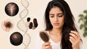 5 signs your hair fall is genetic and not fixable with oils
