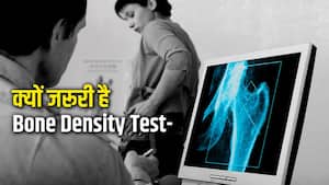 20 की उम्र में कमजोर पड़ रही हैं हड्डियां, तो करवाएं Bone Density Test; डॉक्टर गिनवा रहे हैं इसके फायदे