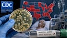 CDC warns drug-resistant candida auris superbug is spreading across 23 states: Who is most at risk?