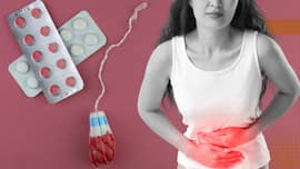 Endometriosis may raise type 2 diabetes risk by 46%, study finds: What women should know