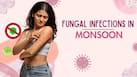 Fungal skin infections rise by up to 35% during monsoon: 7 mistakes that make them harder to treat