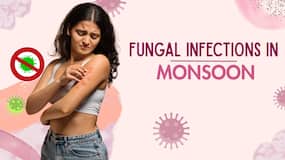 Fungal skin infections rise by up to 35% during monsoon: 7 mistakes that make them harder to treat