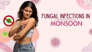 Fungal skin infections rise by up to 35% during monsoon: 7 mistakes that make them harder to treat