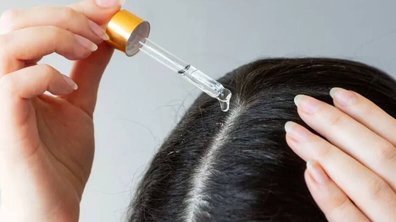5 signs your hair fall is genetic and not fixable with oils