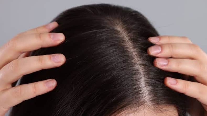 5 signs your hair fall is genetic and not fixable with oils