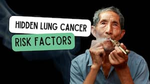 Lung cancer kills nearly 1.8 million people every year: CDC says 1 in 5 cases occur in never-smokers - top risk factors you shouldn't ignore