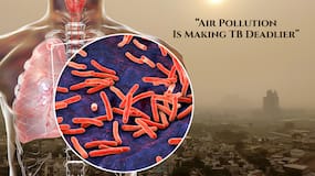 Study links high PM2.5 exposure to increased risk of death among tuberculosis patients during treatment