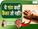 शरीर पर दिखने वाला या गांठ कैंसर है? देखें ये पूरी वीडियो| Lipoma Symptoms