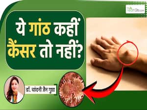 शरीर पर दिखने वाला या गांठ कैंसर है? देखें ये पूरी वीडियो| Lipoma Symptoms