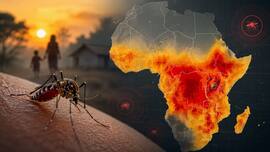 Climate change is shifting childhood malaria hotspots across Africa, finds study