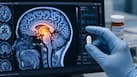 After 60 years, scientists discover metformin works in the brain to control blood sugar