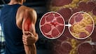 When muscle healing goes wrong, fat takes its place: Here's why