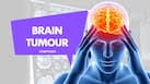 Persistent headache? Doctor reveals 8 brain tumour warning signs you should never ignore