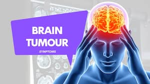 Persistent headache? Doctor reveals 8 brain tumour warning signs you should never ignore