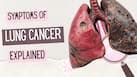 Persistent cough or something more? Early warning signs of lung cancer you should never ignore