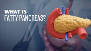 Fatty pancreas may be more dangerous than you think: Know the symptoms, risk factors and treatment