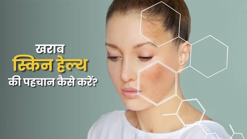किन संकेतों से जानें कि स्किन हेल्थ खराब हो रही है?