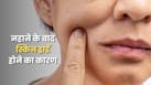 नहाने के बाद त्वचा ड्राई क्यों हो जाती है? इन 5 आदतों को सुधारें
