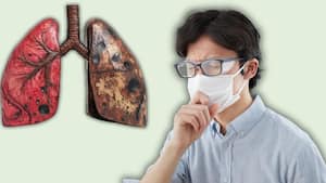 लंग कैंसर के शुरुआती लक्षण क्या हैं? इन संकेतों को बिल्कुल नजरअंदाज न करें