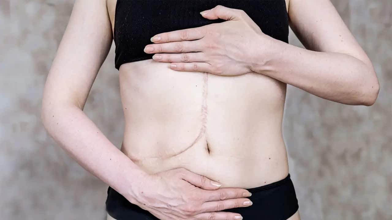 organ donation risks