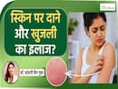 बारिश में होने वाली स्किन से जुड़ी इस समस्या का मिल गया इलाज!