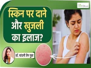 बारिश में होने वाली स्किन से जुड़ी इस समस्या का मिल गया इलाज!
