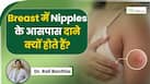 महिलाओं के ब्रेस्ट में निप्पल के आसपास दाने क्यों होते हैं? इस स्थिति में क्या करें